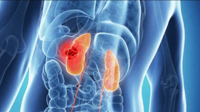 Онкоуролог рассказал, почему отказ от курения &mdash; ключевое правило в профилактике рака у мужчин